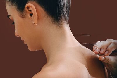 Link to: /pages/why-acupuncture